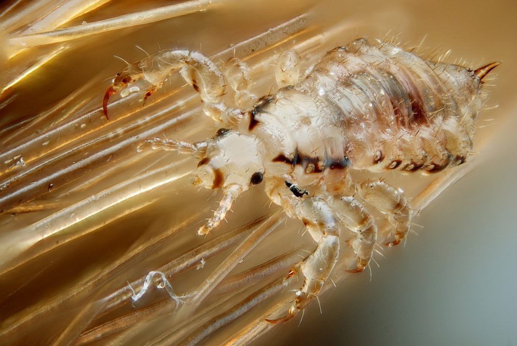 Human Head Lice