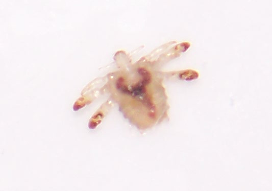 Pubic (Crab) Lice